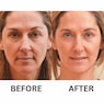 Retinol Wrinkle Miracle, , large