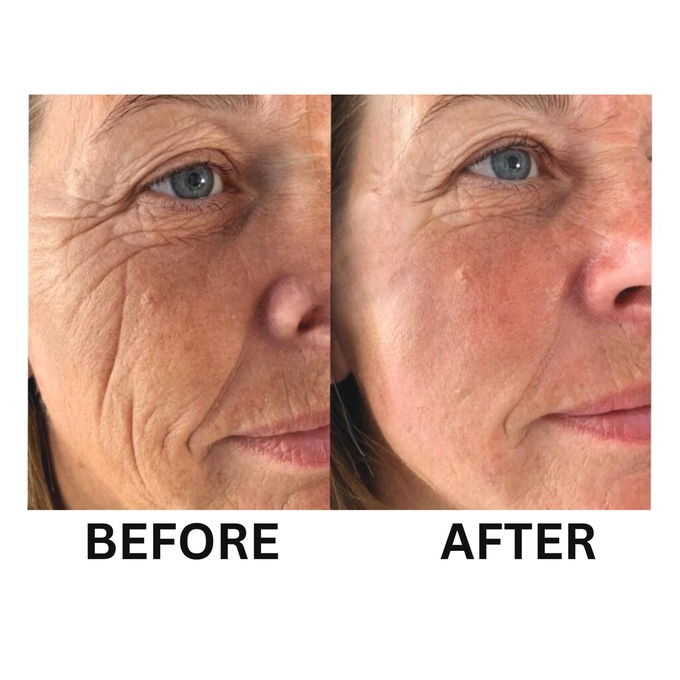 Deep Wrinkle Anti-Aging Cream, , large
