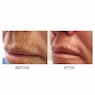 Lip Line Erasing Serum, , large