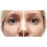 Timeless Beauty Hydrogel Eye Patches, , large