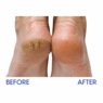 Relief Now Diabetic Dry Skin Relief Foot Cream , , large